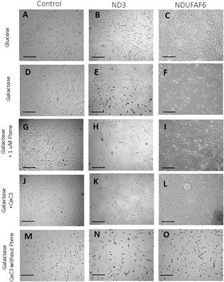 Pterostilbene in Combination With Mitochondrial Cofactors Improve Mitochondrial Function in Cellular Models of Mitochondrial Diseases